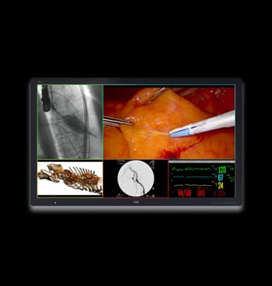 Медичний дисплей FSN FM-D5802DV